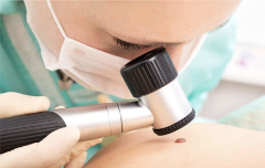 Перевірка родимок у IQDoctor