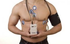 Послуги Холтер-моніторингу в IQDoctor