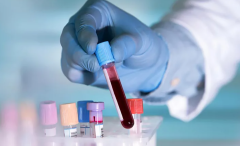 Коагулограмма: что показывает анализ свертывания крови?
