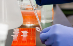 Анализ уровня витамина D: почему это важно для здоровья?