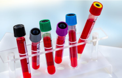 Гормоны стресса: как кортизол и адреналин влияют на здоровье?